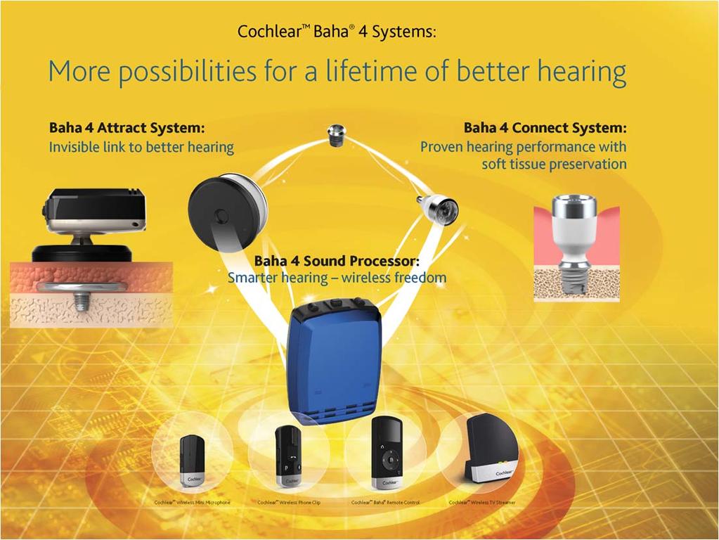 cochlear implant and hearing aid Expanding cochlear implant
