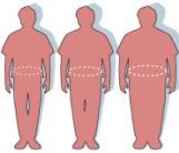 The double burden : Micronutrient deficiencies and health issues Overweight 60 million