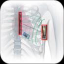 RHYTHMIA HDx LUMIPOINT software Spinal
